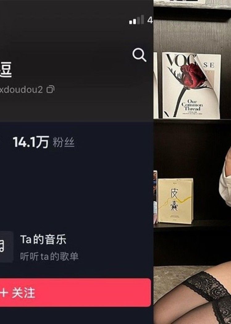 小逗逗 – 微密圈写真&视频合集【持续更新中】